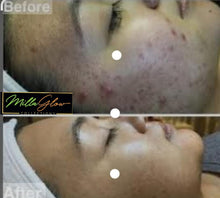 Load image into Gallery viewer, Millaglow  extrat Lightening Lotion